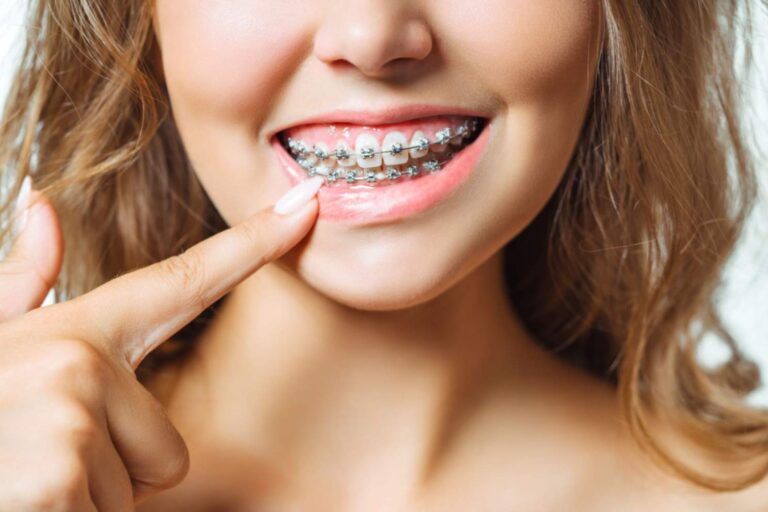 orthodontist in east los angeles